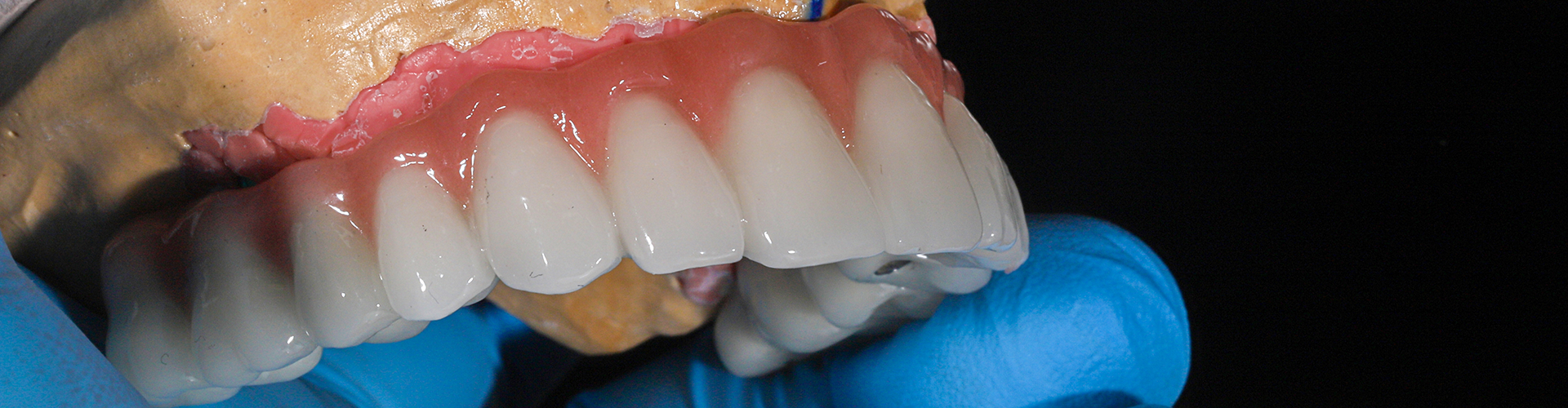 gloved hand holding denture